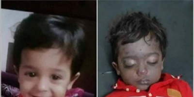 بإشراف مدير أمن عدن " شرطة كريتر" تلقي القبض على المتهمين الرئيسيين بقضية قتل الطفل "قصي الحاجبي "