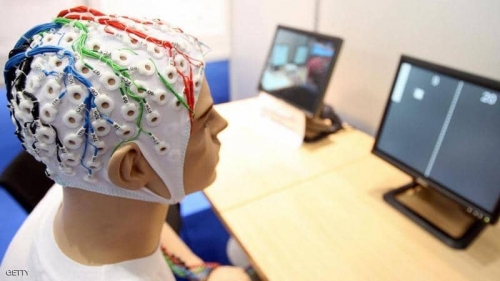 #دراسة تكشف علاقة الذاكرة بالصدمات الكهربائية