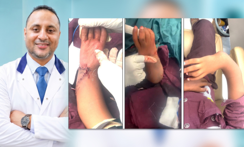 بعد أن فقدت أسرته الأمل.. الدكتور عماد الشعيبي يحقق إنجازاً طبياً في عدن وينهي معاناة طفل استمرت 13 عاماً
